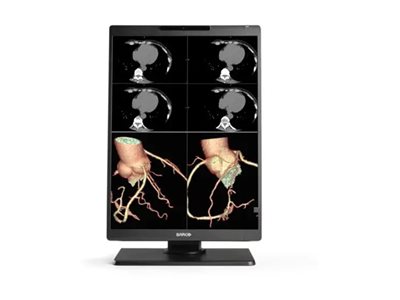 Barco Nio Color 2MP MDNC-2521