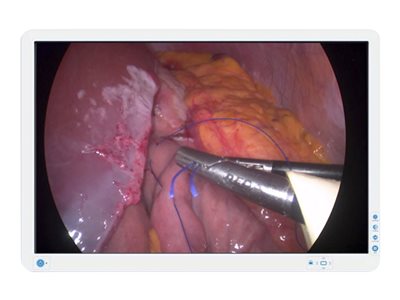 Barco AMM240ED LED monitor color 24INCH (24.07INCH viewable) 1920 x 1200 300 cd/m² 1000:1 