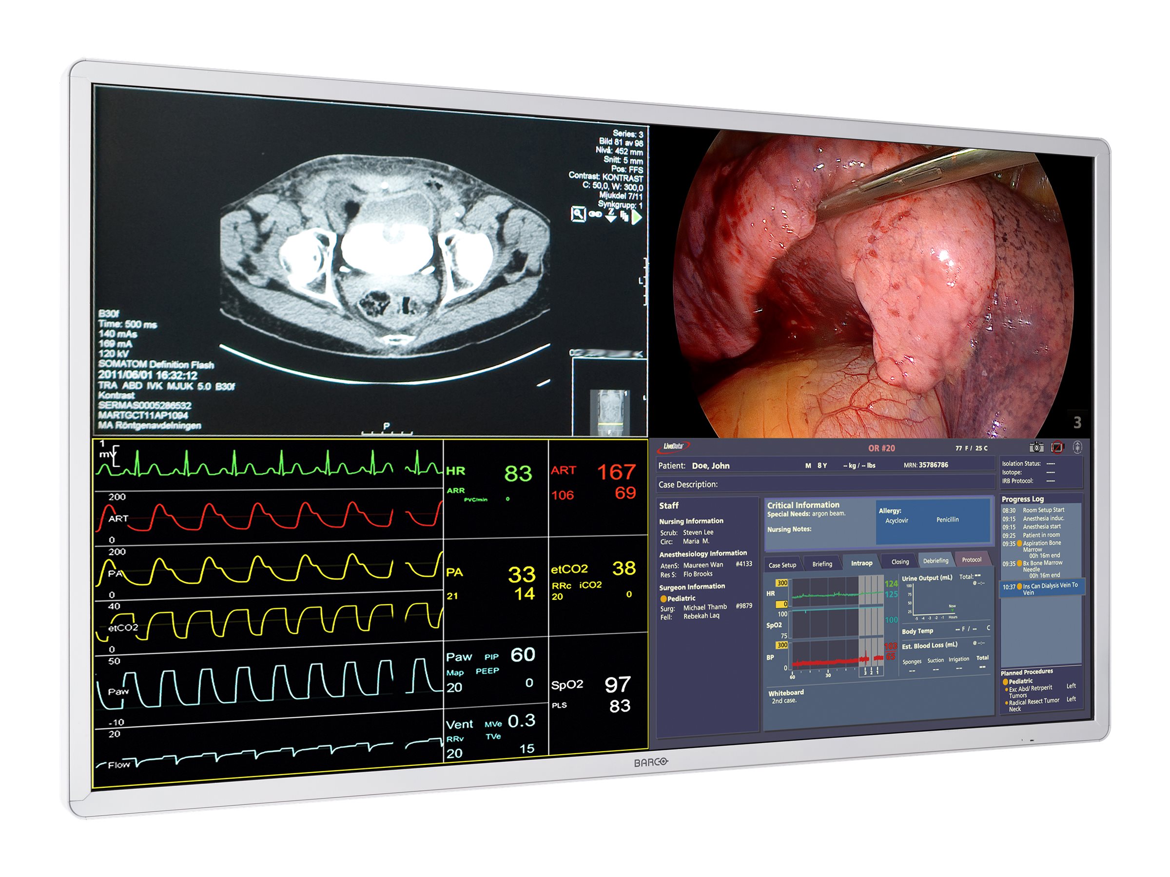 Barco MDSC-8255 - LED monitor
