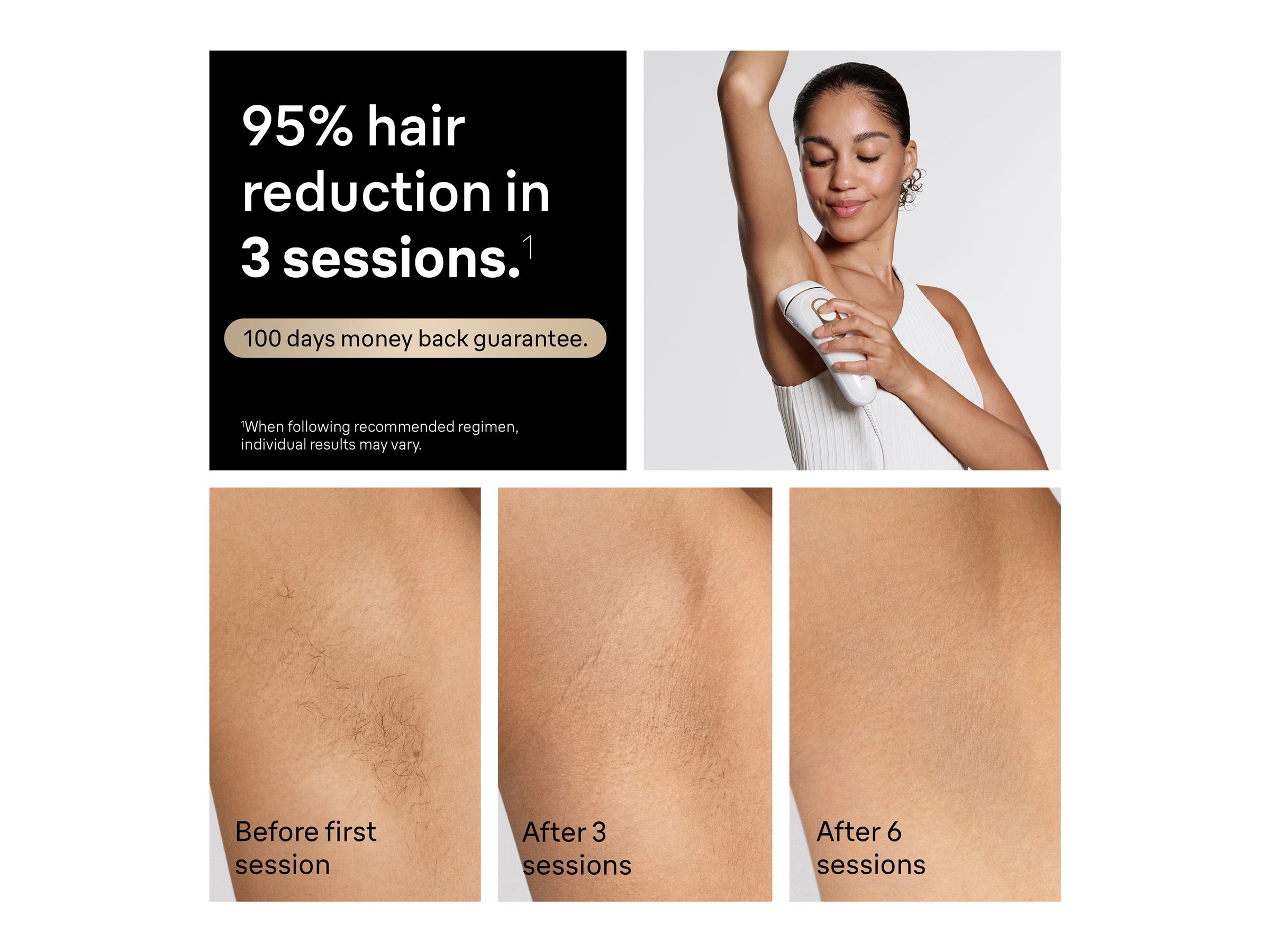 Braun Silk-expert Pro 5 IPL Hair Removal System - PL5157