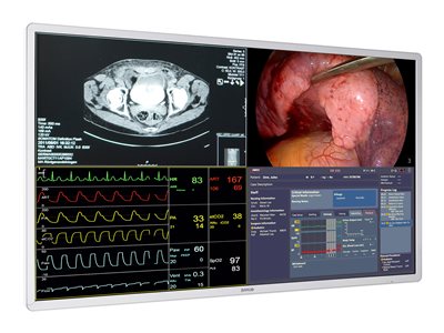 Barco MDSC-8255 - LED monitor