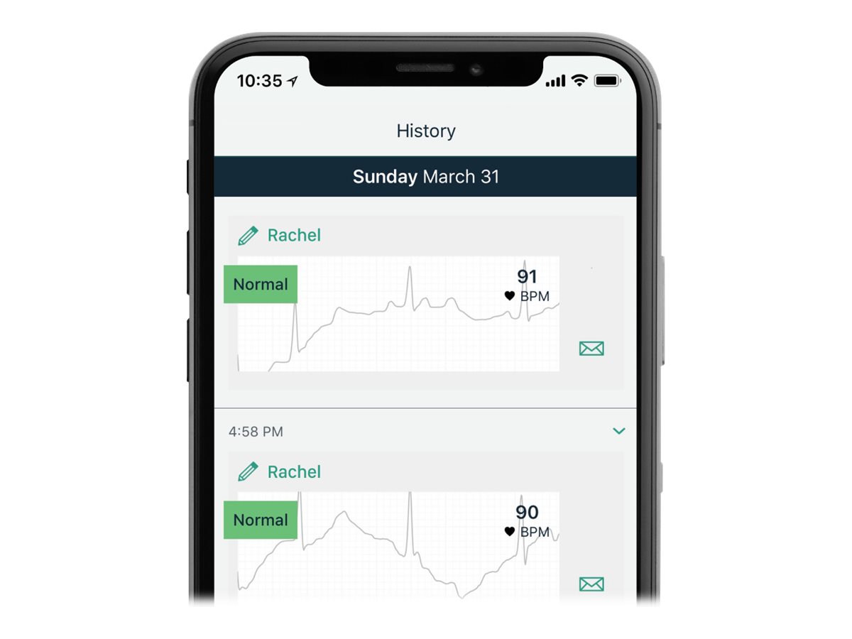 Alive Cor Kardia Mobile mobile EKG be in plastic