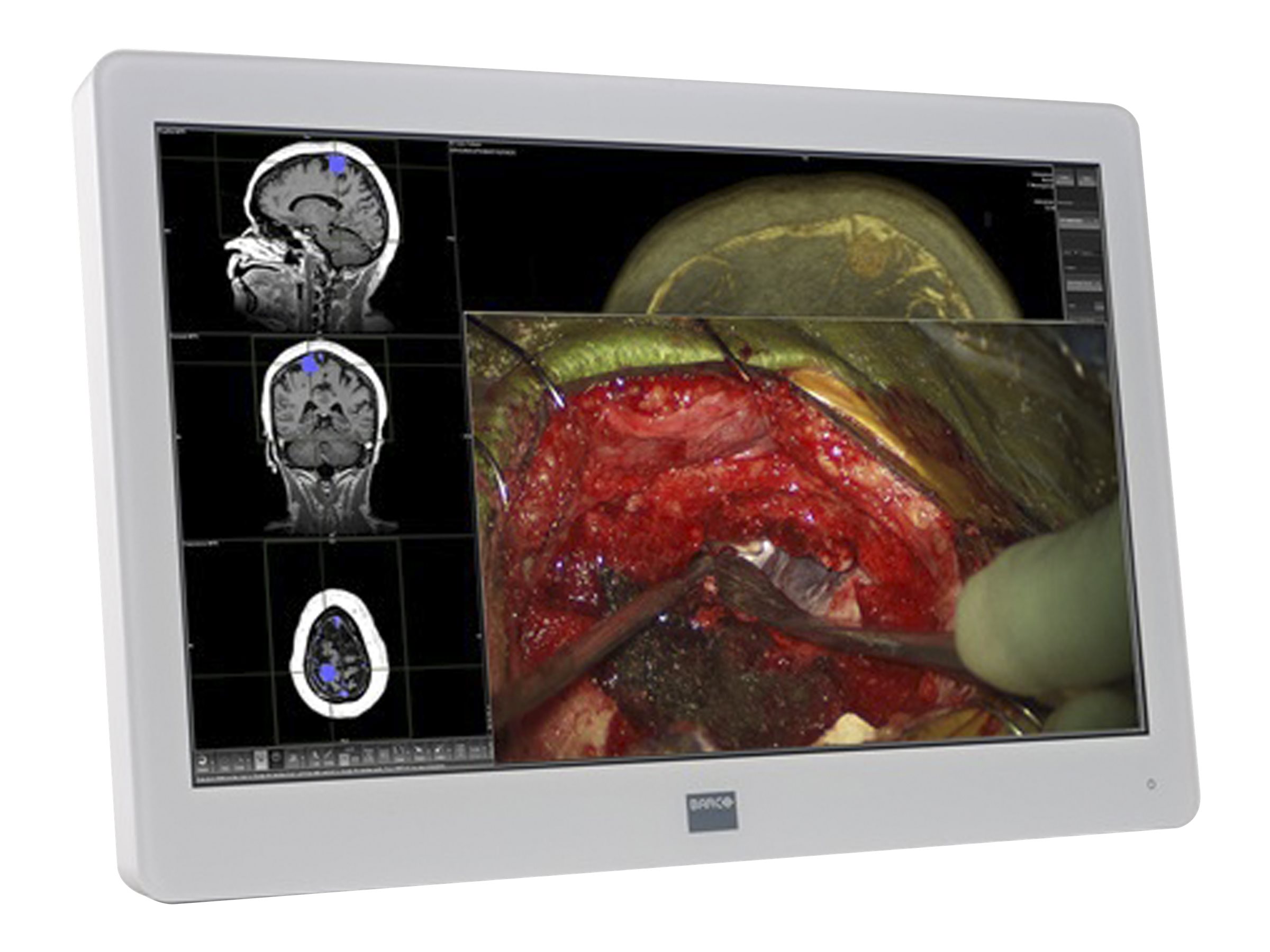 Barco MDSC-2324 DDI - LED monitor