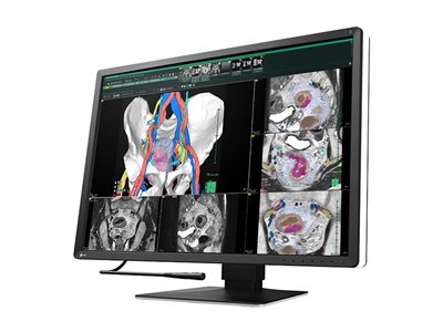 EIZO RadiForce RX670