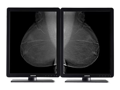 Barco Nio 5MP MDNG-5221