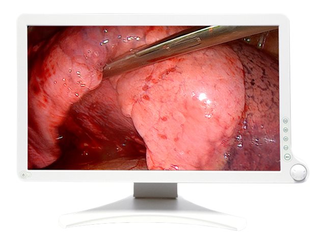 Barco AMM 215WTD - LED monitor