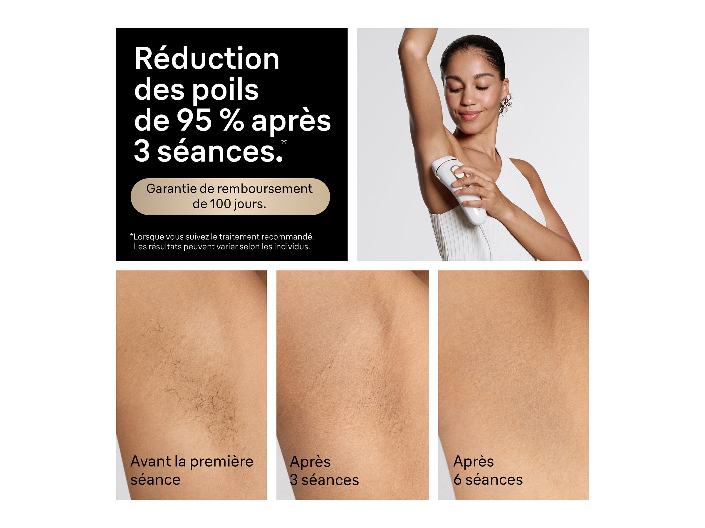 Braun Silk-expert Pro 5 IPL Hair Removal System - PL5157