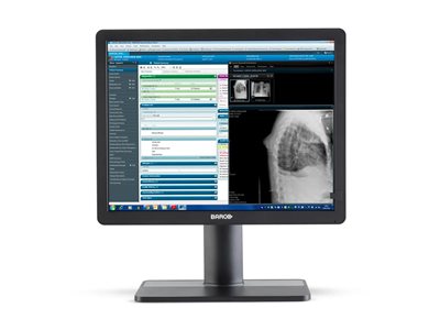 Barco Eonis MDRC-2421 LED monitor 2MP color 21.3INCH 1600 x 1200 IPS 500 cd/m² 