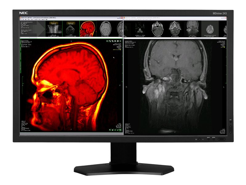 NEC MDview 243 - cran LED - 2MP - couleur - 24.1"