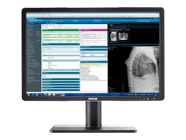 Barco Eonis MDRC-2224 BL