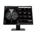 Barco Nio Fusion MDNC-12130