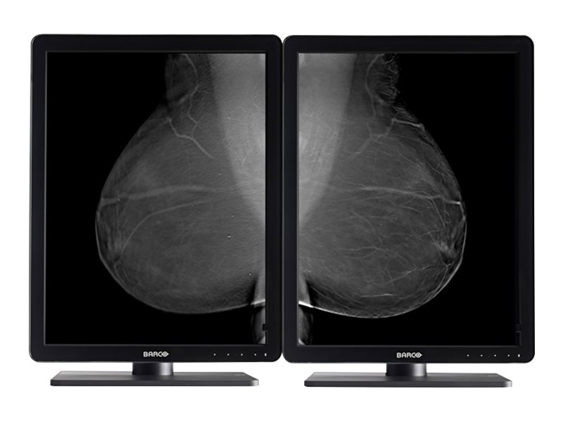 Barco Nio 5MP MDNG-5221