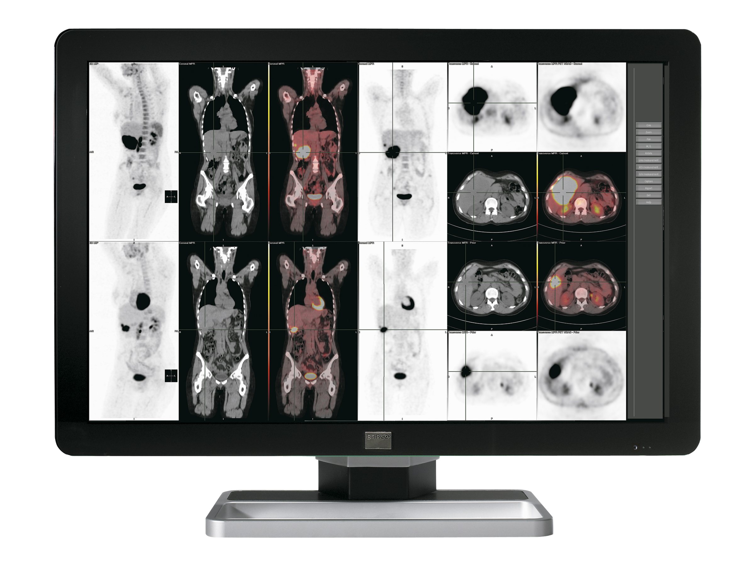 Barco Coronis Fusion 6MP LED MDCC-6230