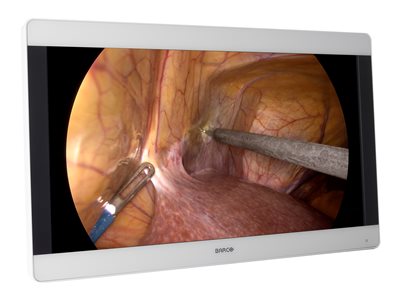 Barco MDSC-8231 LED - LED monitor