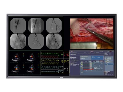 Barco MDSC-8358 RL - LED monitor
