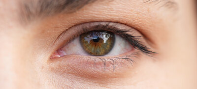 Excellent close-up performance