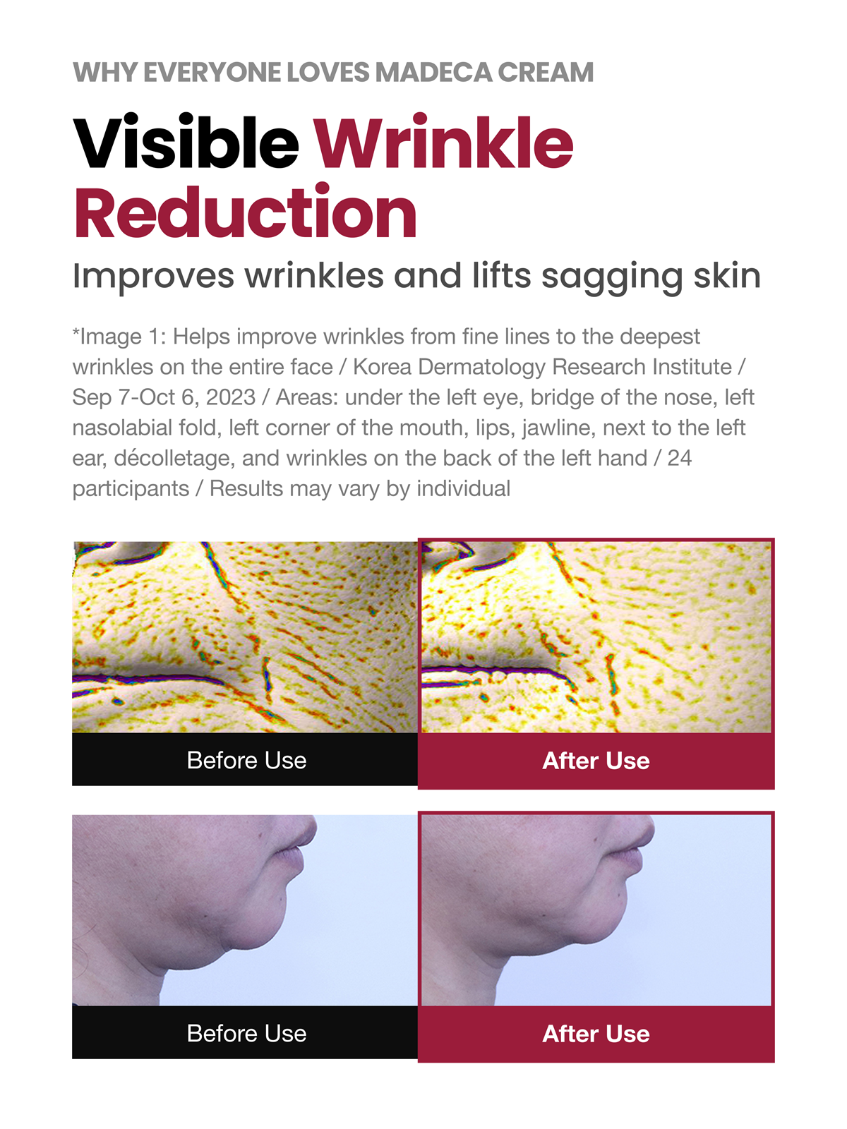 Visible wrinkle reduction clinical results with before and after images showing improved skin texture and firmness using Madeca Cream Time Reverse