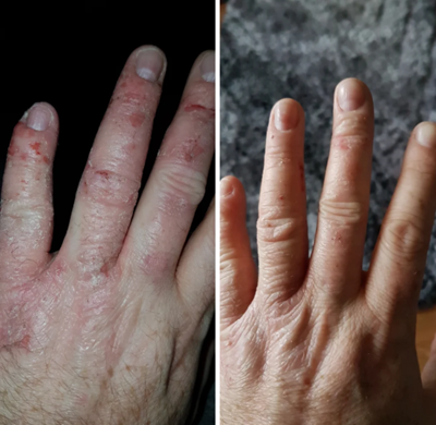 before and after