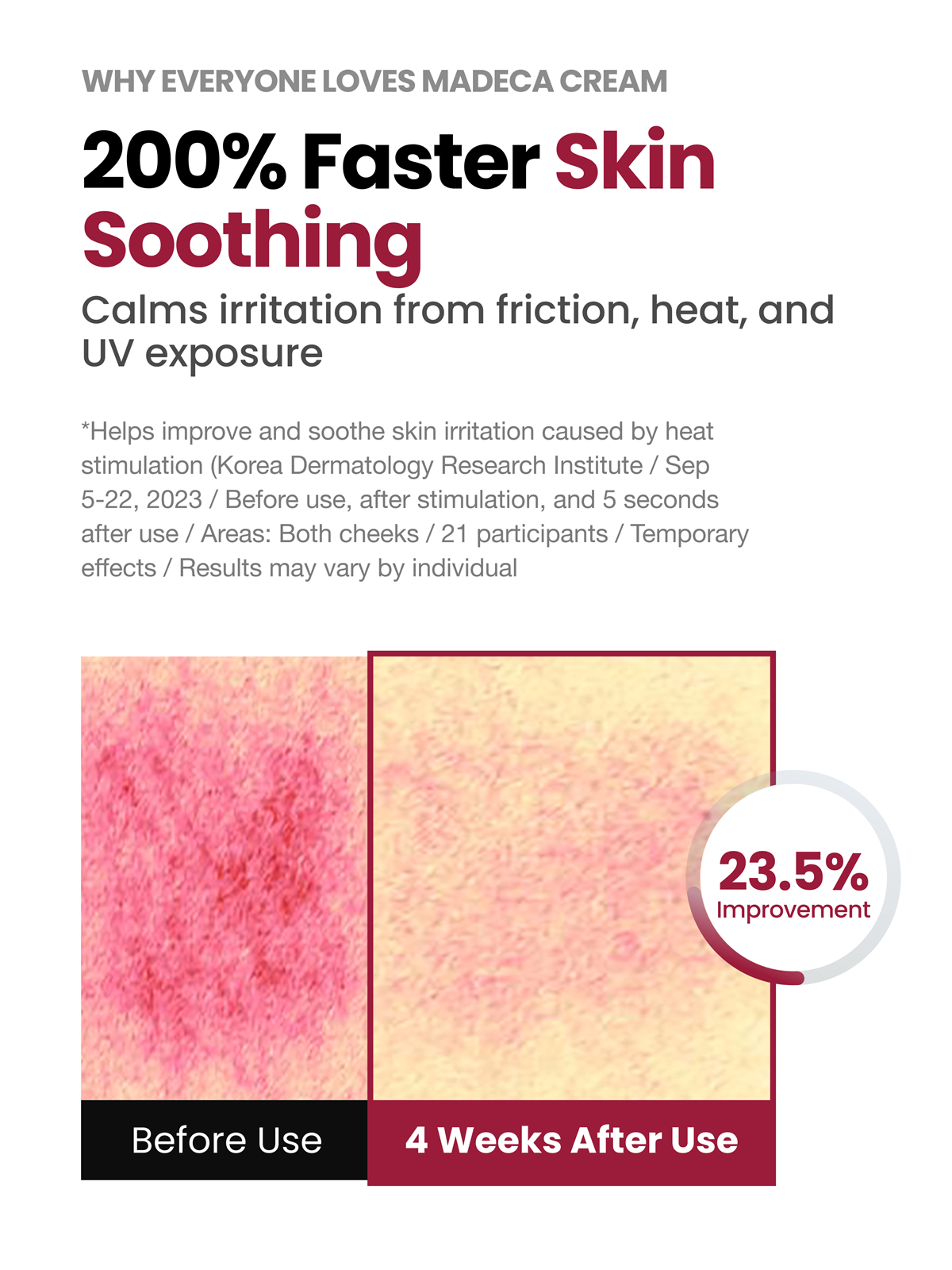 Clinical results showing 200% faster skin soothing with Madeca Cream Time Reverse, before and after images, and 23.5% improvement