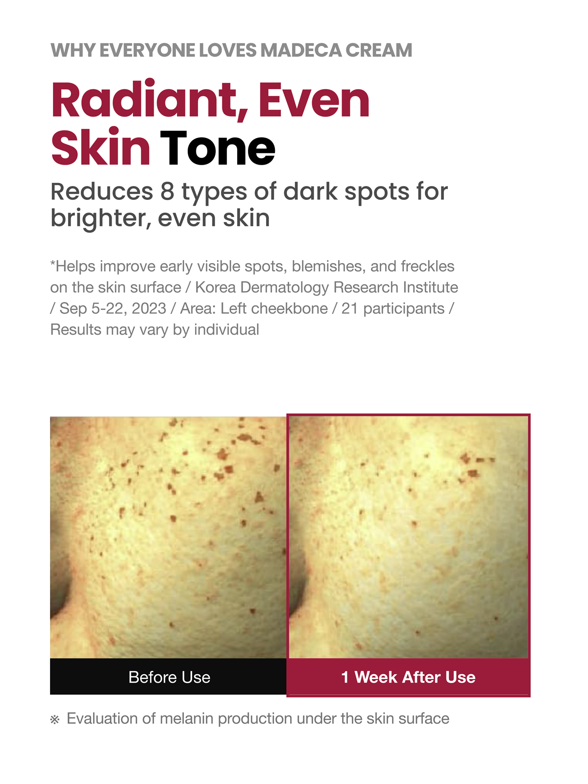 Clinical results showing improved skin tone and dark spot reduction with Madeca Cream Time Reverse, before and after images