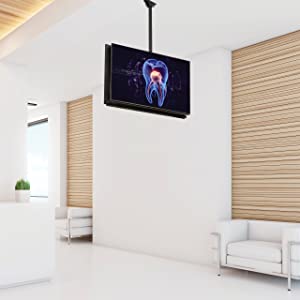 Astonishing Picture Quality